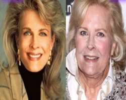 Candice Bergen before surgery